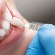 A gloved hand holds a tooth shade guide next to a persons teeth to match the color for dental work.